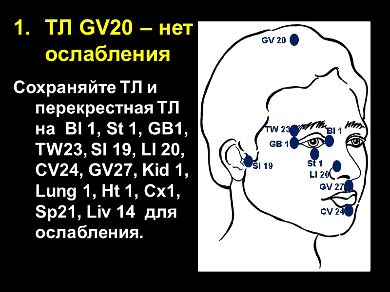 ТЛ GV20 – нет ослабления  Сохраняйте ТЛ и перекрестная ТЛ на  Bl